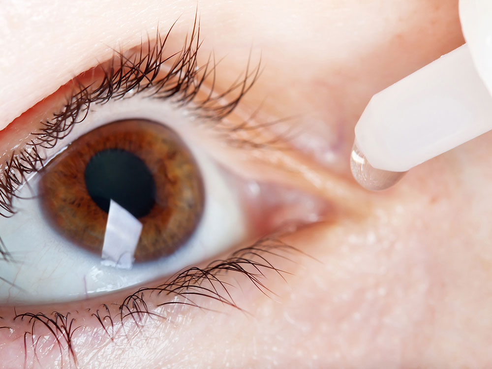 Sindrome Dell Occhio Secco Studio Oculistico Mauceri
